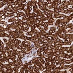 CLYBL Antibody, Novus Biologicals 0.1mL; Unlabeled:Antibodies, Polyclonal