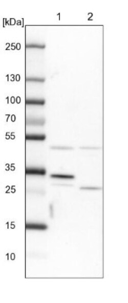 CLYBL Antibody, Novus Biologicals 0.1mL; Unlabeled:Antibodies, Polyclonal
