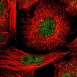 CMTM1 Antibody, Novus Biologicals 0.1mL; Unlabeled:Antibodies, Polyclonal