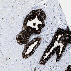 CMTM1 Antibody, Novus Biologicals 0.1mL; Unlabeled:Antibodies, Polyclonal