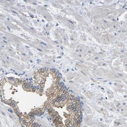 CMTM1 Antibody, Novus Biologicals 0.1mL; Unlabeled:Antibodies, Polyclonal