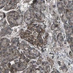 CMTM4 Antibody, Novus Biologicals 0.1mL; Unlabeled:Antibodies