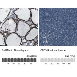 CMTM4 Antibody, Novus Biologicals 0.1mL; Unlabeled:Antibodies