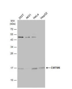CMTM6 Antibody, Novus Biologicals 0.1mg; Unlabeled:Antibodies, Polyclonal