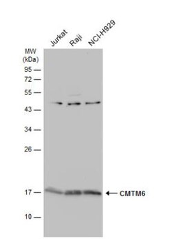 CMTM6 Antibody, Novus Biologicals 0.1mg; Unlabeled:Antibodies, Polyclonal