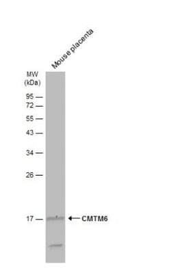 CMTM6 Antibody, Novus Biologicals 0.1mg; Unlabeled:Antibodies, Polyclonal