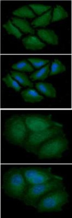 CNBP Antibody (38F10) - BSA Free, Novus Biologicals 100 &mu;L | Buy Online | Novus Biologicals | Fisher Scientific