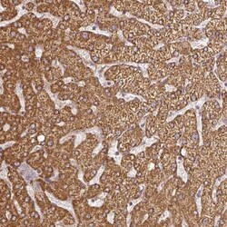 CNOT1 Antibody, Novus Biologicals:Antibodies:Primary Antibodies