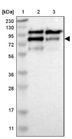 CNOT3 Antibody, Novus Biologicals 0.1mL; Unlabeled:Antibodies, Polyclonal