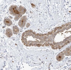 CNP/NPPC Antibody, Novus Biologicals 25 &mu;L; Unlabeled:Antibodies, Polyclonal