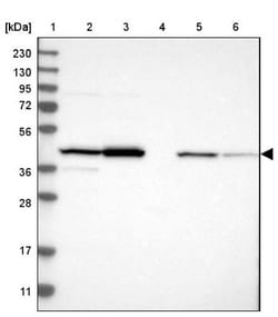 CNPase Antibody, Novus Biologicals 0.1mL; Unlabeled:Antibodies, Polyclonal
