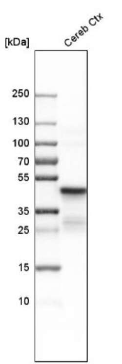 CNPase Antibody, Novus Biologicals 0.1mL; Unlabeled:Antibodies, Polyclonal