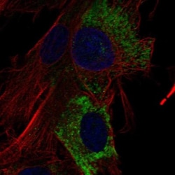 COL15A1 Antibody, Novus Biologicals:Antibodies:Primary Antibodies