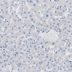 COL15A1 Antibody, Novus Biologicals:Antibodies:Primary Antibodies
