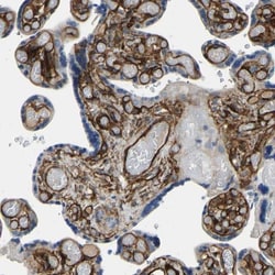 COL15A1 Antibody, Novus Biologicals:Antibodies:Primary Antibodies