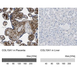 COL15A1 Antibody, Novus Biologicals:Antibodies:Primary Antibodies