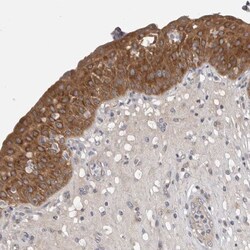 COL22A1 Antibody, Novus Biologicals:Antibodies:Primary Antibodies