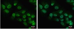 COMMD7 Antibody, Novus Biologicals 0.1mg; Unlabeled:Antibodies, Polyclonal