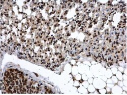 COMMD7 Antibody, Novus Biologicals 0.1mg; Unlabeled:Antibodies, Polyclonal