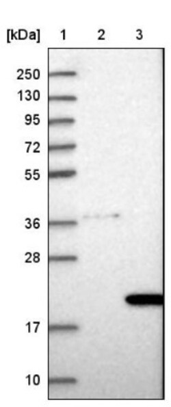 COMMD8 Antibody, Novus Biologicals:Antibodies:Primary Antibodies