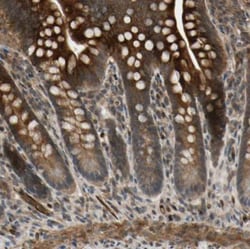 COMMD9 Antibody, Novus Biologicals:Antibodies:Primary Antibodies