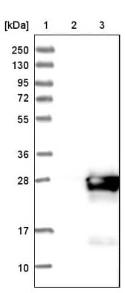 COMMD9 Antibody, Novus Biologicals:Antibodies:Primary Antibodies