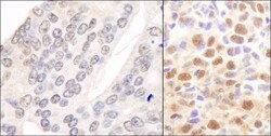 COP9 signalosome complex subunit 2 Antibody, Novus Biologicals 0.1mg; Unlabeled:Antibodies,