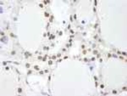 COP9 signalosome complex subunit 2 Antibody, Novus Biologicals 0.1mg; Unlabeled:Antibodies,