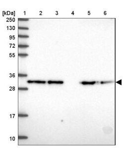 COPE Antibody, Novus Biologicals 0.1mL; Unlabeled:Antibodies, Polyclonal