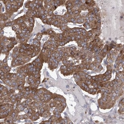 COQ3 Antibody, Novus Biologicals:Antibodies:Primary Antibodies