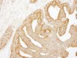 CORO1B Antibody, Novus Biologicals 0.1mL; Unlabeled:Antibodies, Polyclonal