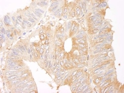CORO1B Antibody, Novus Biologicals 0.1mL; Unlabeled:Antibodies, Polyclonal