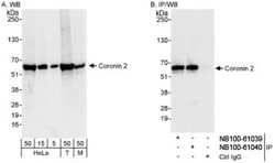 CORO1B Antibody, Novus Biologicals 0.1mL; Unlabeled:Antibodies, Polyclonal