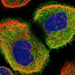 CORO2A Antibody, Novus Biologicals 25 &mu;L; Unlabeled:Antibodies, Polyclonal