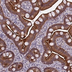 CORO2A Antibody, Novus Biologicals 0.1mL; Unlabeled:Antibodies, Polyclonal
