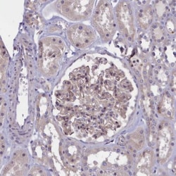 CORO2A Antibody, Novus Biologicals 25 &mu;L; Unlabeled:Antibodies, Polyclonal