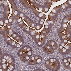 CORO2A Antibody, Novus Biologicals 25 &mu;L; Unlabeled:Antibodies, Polyclonal