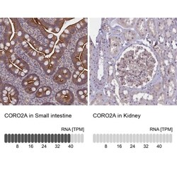 CORO2A Antibody, Novus Biologicals 25 &mu;L; Unlabeled:Antibodies, Polyclonal