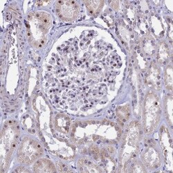 CORO2A Antibody, Novus Biologicals 0.1mL; Unlabeled:Antibodies, Polyclonal