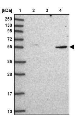 CORO2A Antibody, Novus Biologicals 0.1mL; Unlabeled:Antibodies, Polyclonal