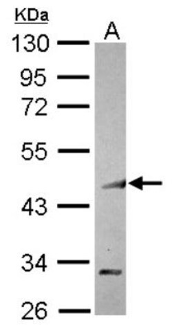COUP-TF I/NR2F1 Antibody, Novus Biologicals 0.1mL; Unlabeled:Antibodies,