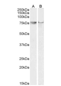 COX-2 Antibody, Novus Biologicals 0.1mg; Unlabeled:Antibodies, Polyclonal