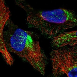 ANKRD45 Antibody, Novus Biologicals:Antibodies:Primary Antibodies