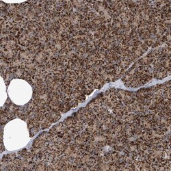 ANKRD45 Antibody, Novus Biologicals:Antibodies:Primary Antibodies