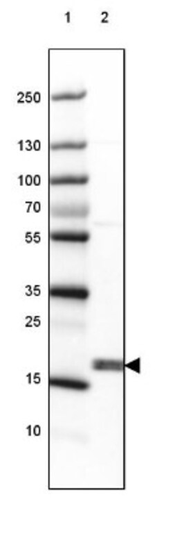 CPI17 alpha Antibody, Novus Biologicals 0.1mL; Unlabeled:Antibodies, Polyclonal