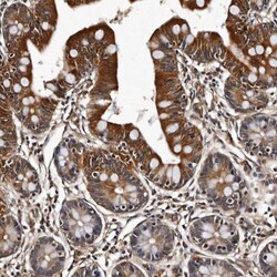 CPNE3 Antibody, Novus Biologicals 0.1mL; Unlabeled:Antibodies, Polyclonal