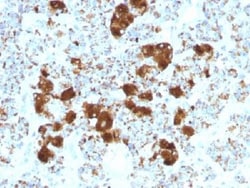 CPS1 Antibody (CPS1/1022), Novus Biologicals 0.2mg; Unlabeled:Antibodies,