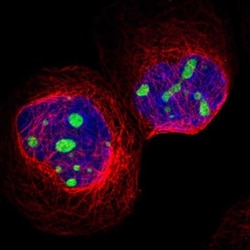 CPS1 Antibody, Novus Biologicals 0.1mL; Unlabeled:Antibodies, Polyclonal