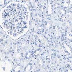 CPS1 Antibody, Novus Biologicals 0.1mL; Unlabeled:Antibodies, Polyclonal