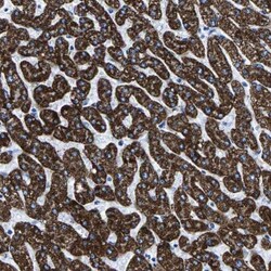 CPS1 Antibody, Novus Biologicals 0.1mL; Unlabeled:Antibodies, Polyclonal